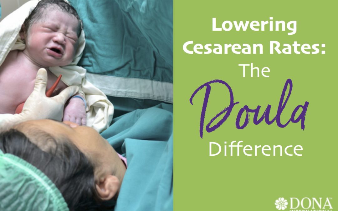 The Doula Difference: Lowering Cesarean Rates