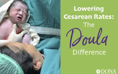 The Doula Difference: Lowering Cesarean Rates