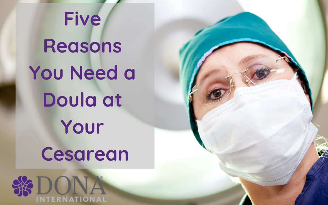 Five Reasons You May Want a Birth Doula During Your Cesarean Birth
